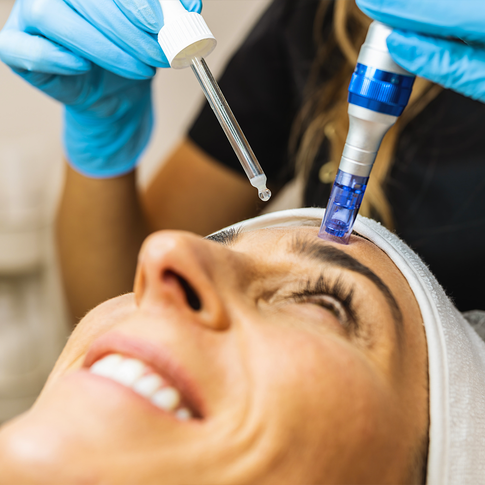 MicroNeedling